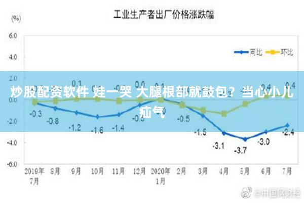 炒股配资软件 娃一哭 大腿根部就鼓包？当心小儿疝气